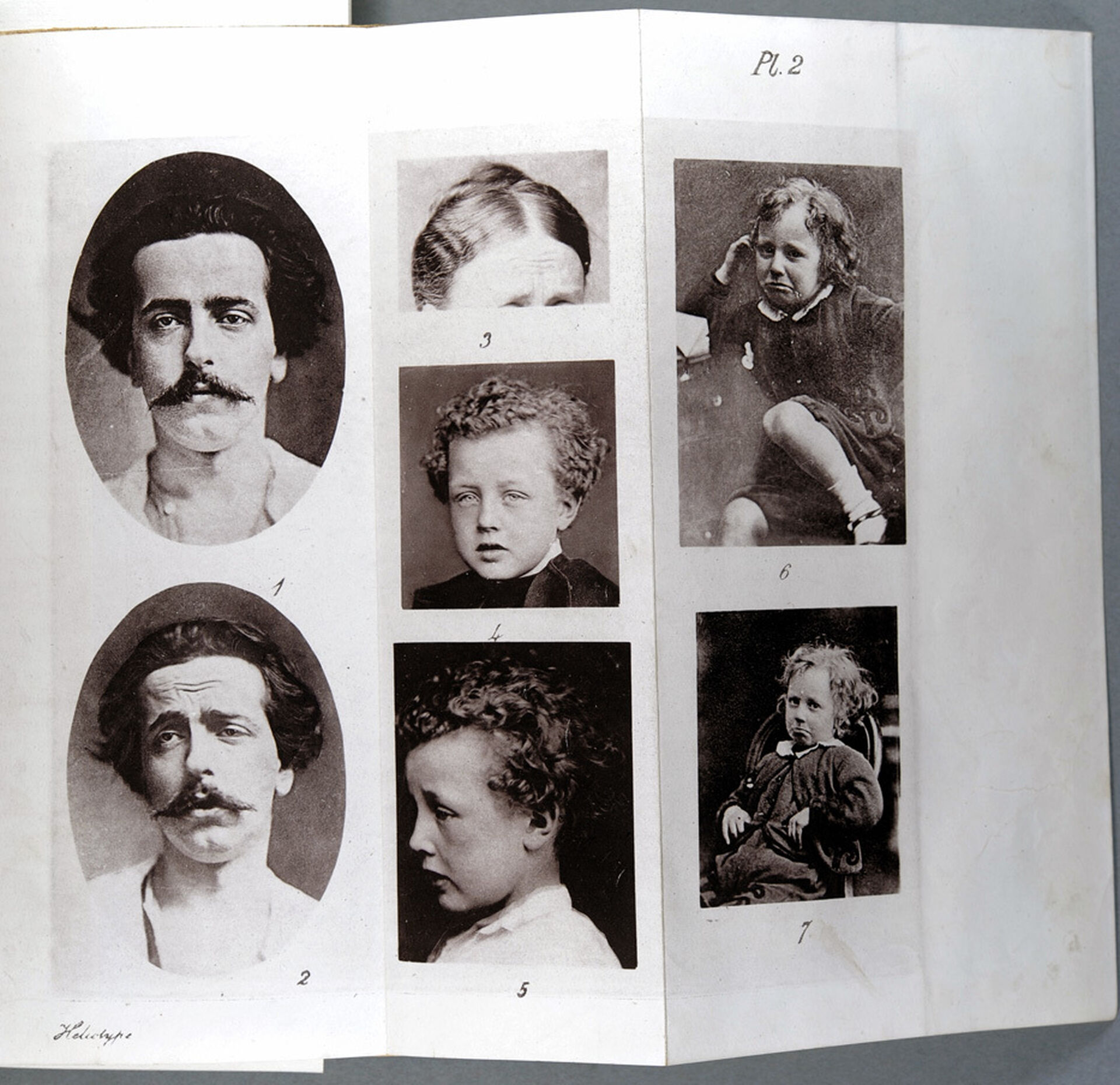Pictures in Charles Dawrwin's book The Expression of the Emotions in Man and Animals, showing "Sorrow".