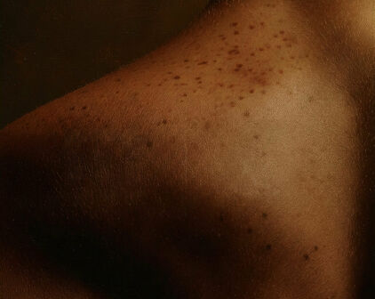 Brun hud med fräknar på någons axel.